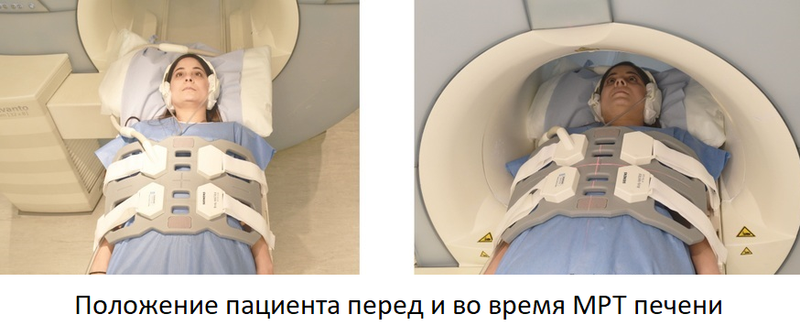 подготовка к МРТ