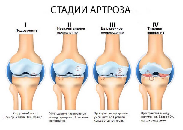 Лечение коленного сустава в Краснодаре